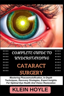 Complete Guide To Understanding Cataract Surgery Mastering