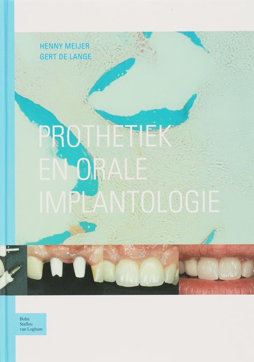 Prothetiek en orale implantologie -  G. de Lange, H. Meijer (ISBN: 9789031341436)