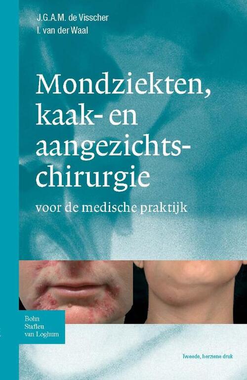 Zakboek mondziekten, kaak- en aangezichtchirurgie -  I. van de Waal, J.G.A.M. de Visscher (ISBN: 9789031363308)