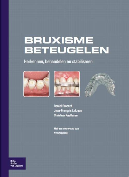 Bruxisme beteugelen -  Christian Knellesen (ISBN: 9789031376131)