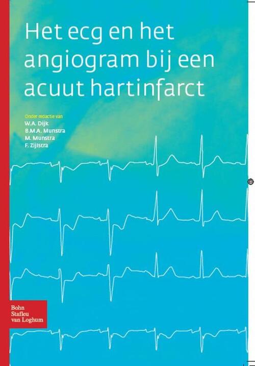 Het ECG en het angiogram bij een acuut hartinfarct -  B.M.A. Munstra, F. Zijlstra, M. Munstra, W.A. Dijk (ISBN: 9789031378210)