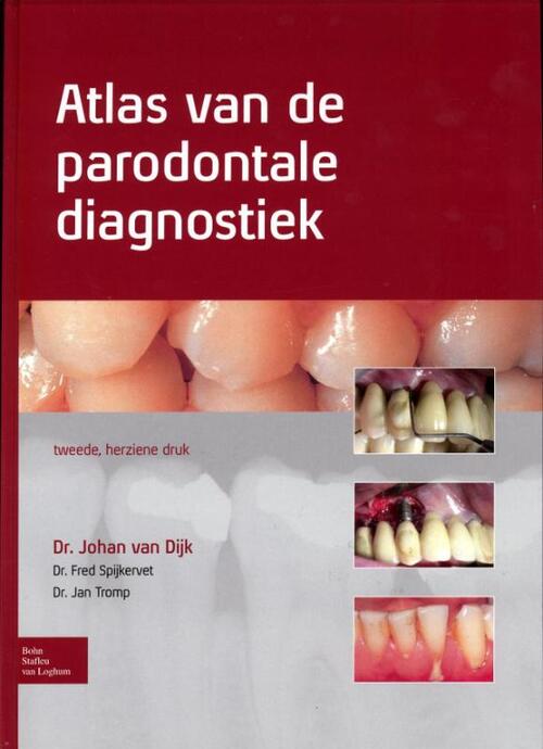 Atlas van de parodontale diagnostiek -  Fred Spijkervet, Jan Tromp, Johan van Dijk (ISBN: 9789031388097)