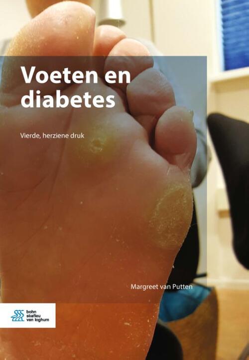 Voeten en diabetes -  Margreet van Putten (ISBN: 9789036802789)