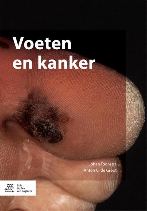 Voeten en kanker -  Anton C. de Groot, Johan Toonstra (ISBN: 9789036810708)