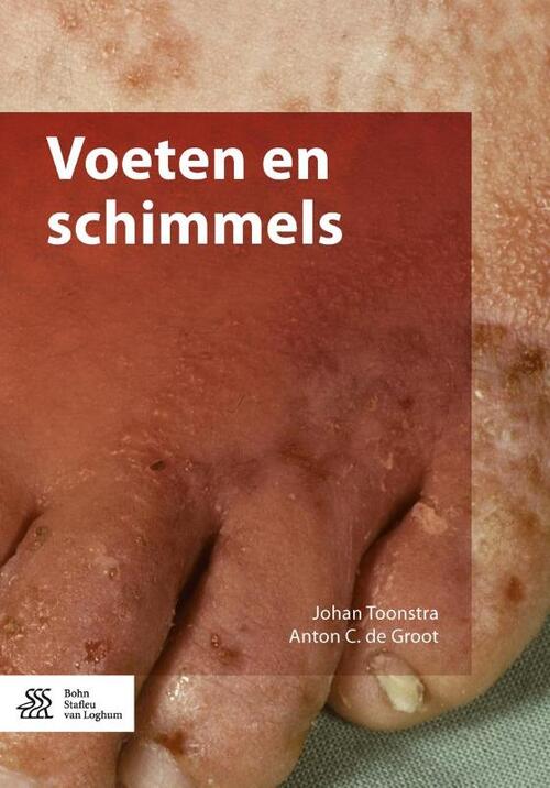 Voeten en schimmels -  Anton C. de Groot, Johan Toonstra (ISBN: 9789036811682)