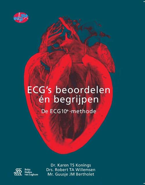 ECG's - beoordelen én begrijpen -  Guusje Bertholet, Karen Konings, Robert Willemsen (ISBN: 9789036817288)