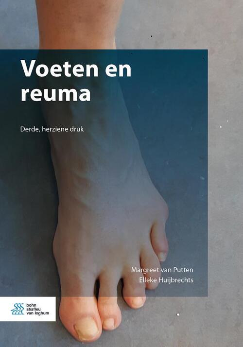 Voeten en reuma -  Elleke Huijbrechts, Margreet van Putten (ISBN: 9789036823777)