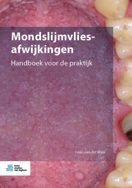 Mondslijmvliesafwijkingen -  Isaäc van der Waal (ISBN: 9789036824019)