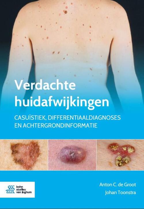 Verdachte huidafwijkingen -  Anton C. de Groot, Johan Toonstra (ISBN: 9789036824668)