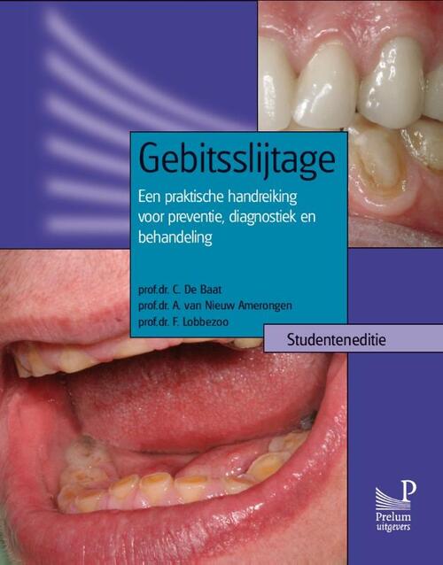 Gebitsslijtage -  A. van Nieuw Amerongen, C. de Baat, F. Lobbezoo (ISBN: 9789085620556)