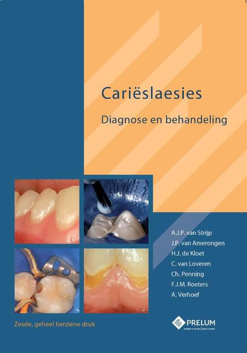 Carieslaesies -  A.J.P. van Strijp (ISBN: 9789085621300)