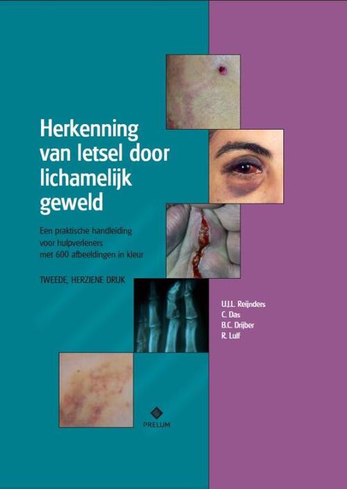 Herkenning van letsel door lichamelijk geweld -  B.C. Drijber, C. Das, R. Luif, U.J.L. Reijnders (ISBN: 9789085621553)