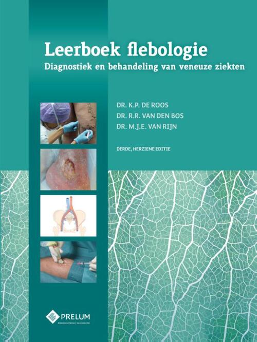 Leerboek flebologie -  D.C. Bijdevaate, J.S. Biedermann (ISBN: 9789085621751)