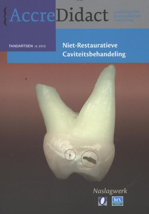 Niet-restauratieve caviteitsbehandeling -  R.J.M. Gruythuysen (ISBN: 9789089760999)