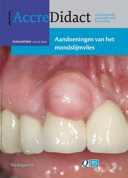 Aandoeningen van het mondslijmvlies -  Isaac van der Waal (ISBN: 9789089761224)