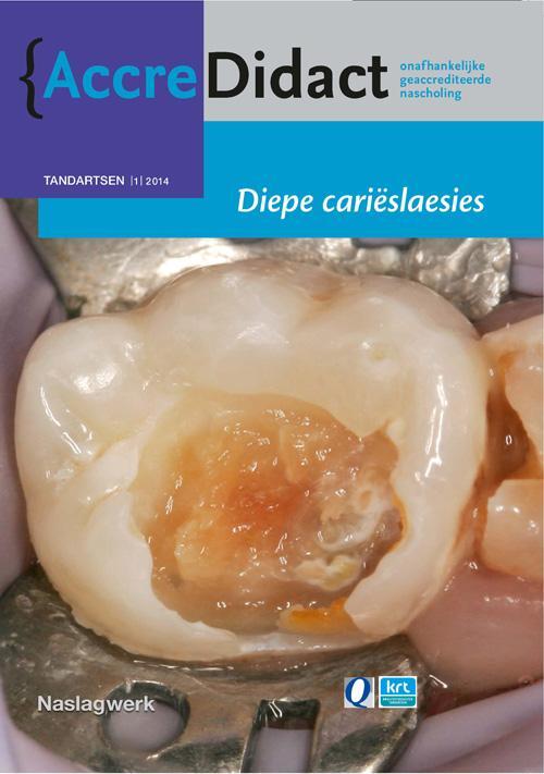 Diepe carieslaesies -  A.J.P. van Strijp, E. Tijskens, R. Gruythuysen (ISBN: 9789089761460)