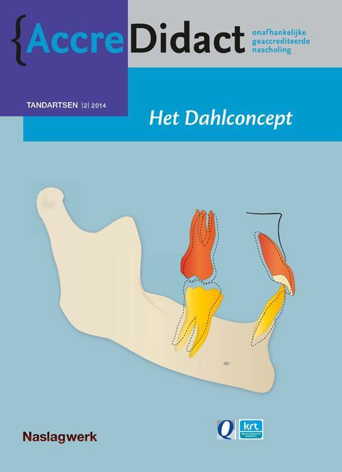 Het dahlconcept -  Kya Wabeke (ISBN: 9789089761521)