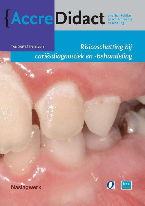 Risicoschatting bij cariësdiagnostiek en -behandeling gebaseerd op risicoschatting -  Cor van Loveren, Gert Stel (ISBN: 9789089761781)