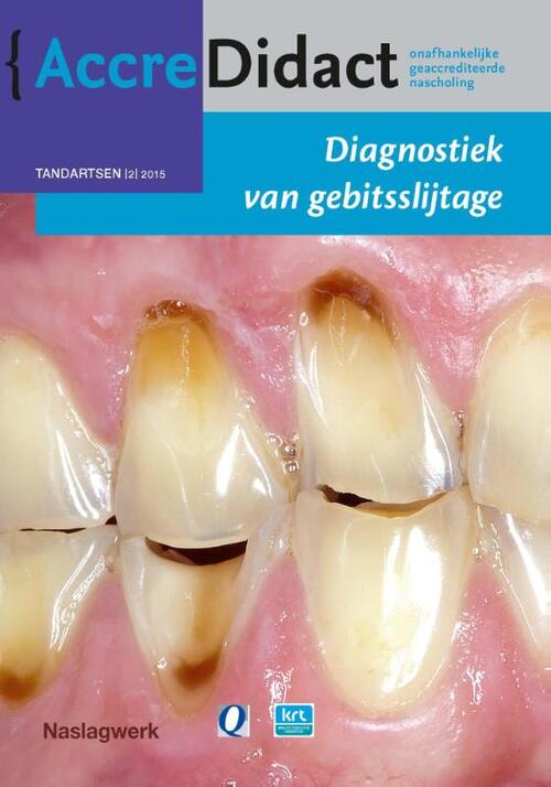 Diagnostiek van gebitsslijtage -  Frank Lobbezoo, Peter Wetselaar (ISBN: 9789089761866)