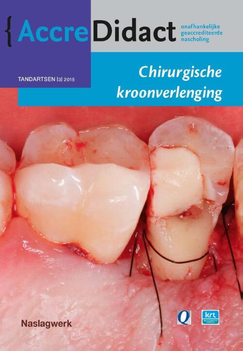 Chirurgische kroonverlenging -  S. Paraskevas (ISBN: 9789089761958)