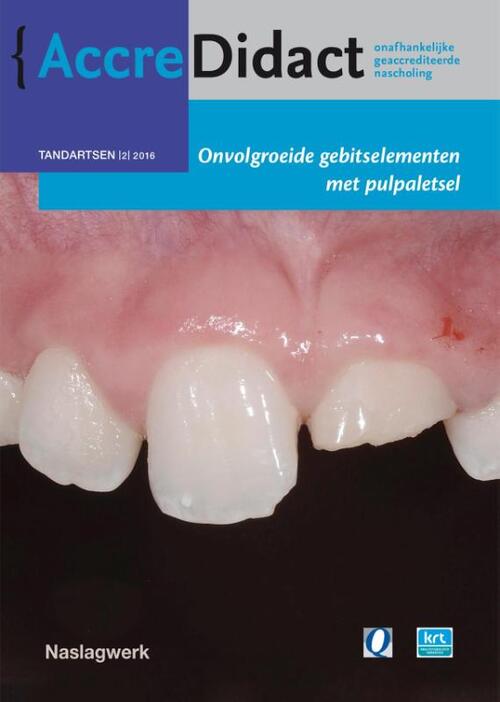 Onvolgroeide gebitselementen met pulpaletsel -  Marga Ree (ISBN: 9789089762108)