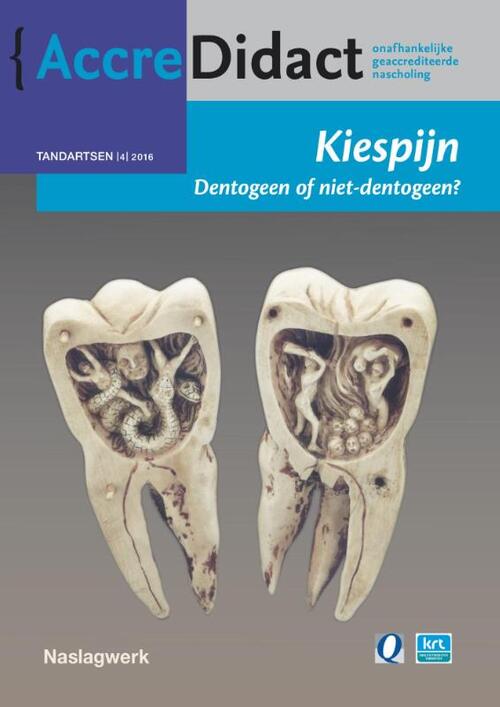 Kiespijn, dentogeen of niet-dentogeen? -  Jan Warnsinck (ISBN: 9789089762276)