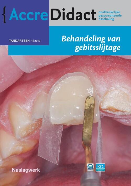 Behandeling van gebitsslijtage -  Bas Loomans (ISBN: 9789089762771)