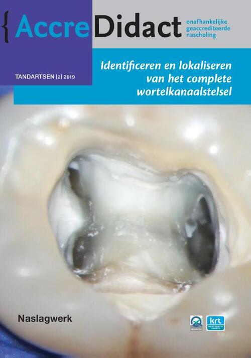 Identificeren en lokaliseren van het complete wortelkanaalstelsel -  Michael Drefs (ISBN: 9789089763198)