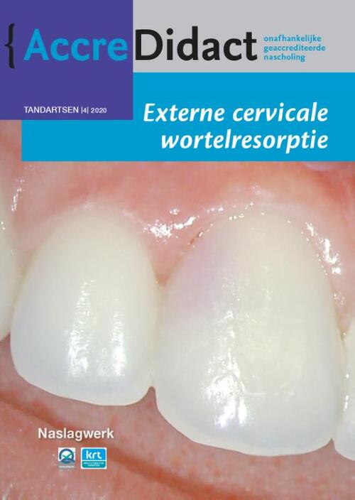 Externe cervicale wortelresorptie -  Athina Mavridou (ISBN: 9789089763754)