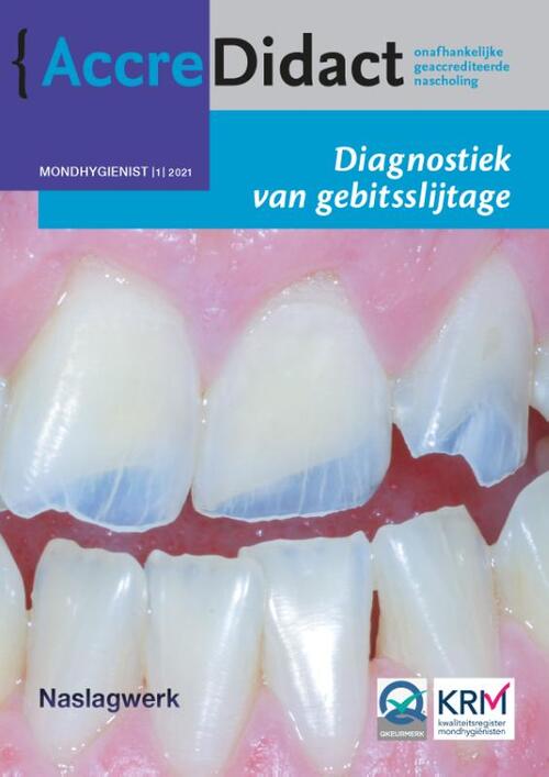 Diagnostiek van gebitsslijtage -  Frank Lobbezoo, Peter Wetselaar (ISBN: 9789089763785)