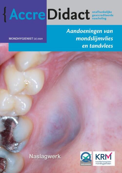 Aandoeningen van mondslijmvlies en tandvlees -  Isaäc van der Waal (ISBN: 9789089763884)