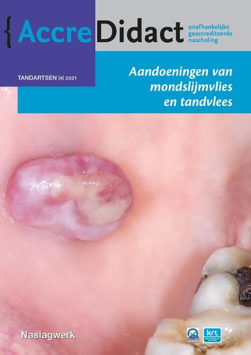 Aandoeningen van mondslijmvlies en tandvlees -  Isaäc van der Waal (ISBN: 9789089764096)