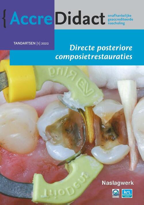 Directe posteriore composietrestauraties -  Bas Loomans, Niek Opdam (ISBN: 9789089764300)