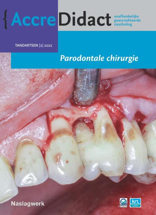 Parodontale chirurgie -  Alexander Verhelst (ISBN: 9789089764577)