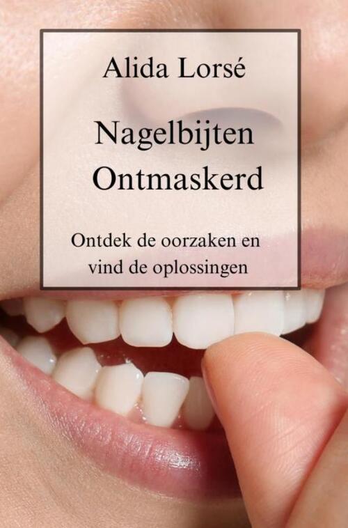 Alida Lorsé Nagelbijten Ontmaskerd -   (ISBN: 9789403751610)