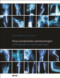 Musculoskeletale aandoeningen -  Jan Victor, Johan Bellemans (ISBN: 9789463443890)